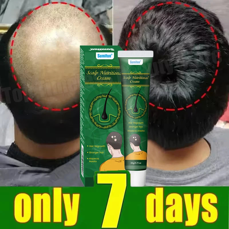 Fast Ginger Hair Growth Cream Anti Hair Loss Baldness Repair Damaged Scalp Treatment Nourish Hair Root Care Products Women Men